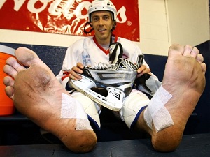 hockey-skate-foot-pain